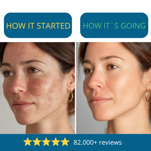 Kill Dark Spots & Uneven Skin