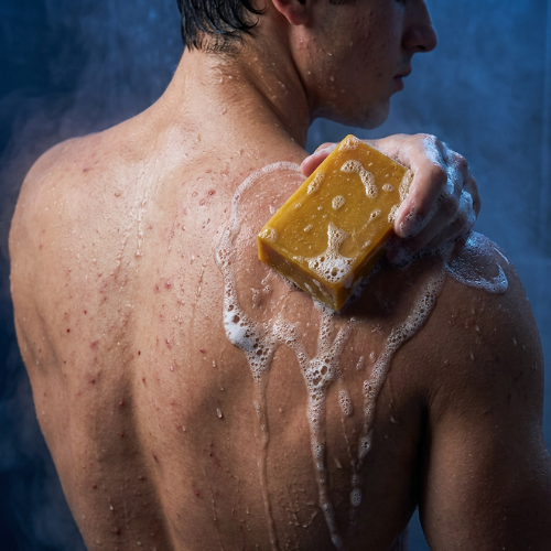 Body Acne Bar